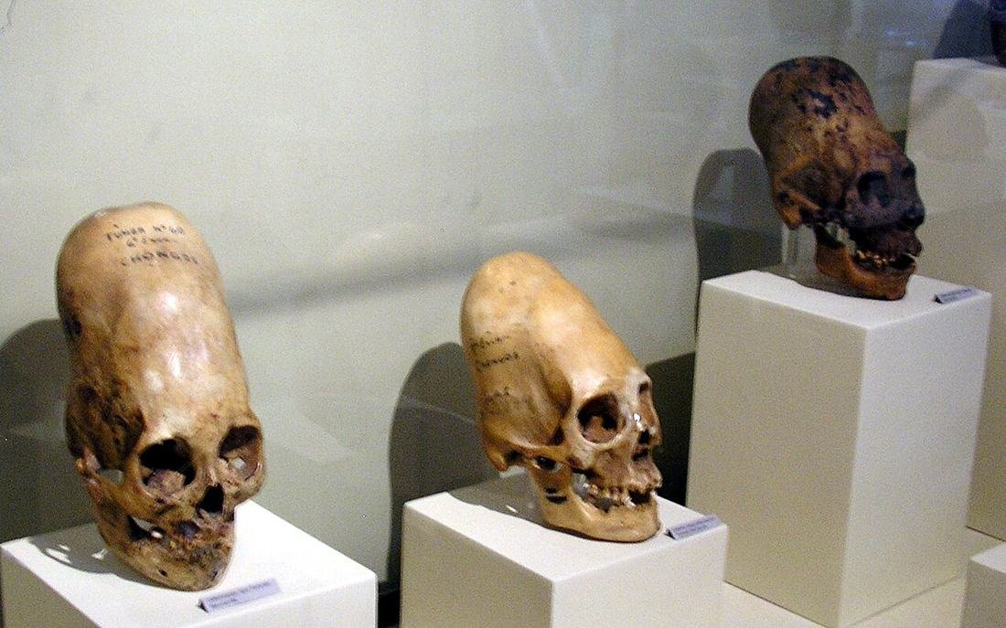 Paracas Elongated Skulls
